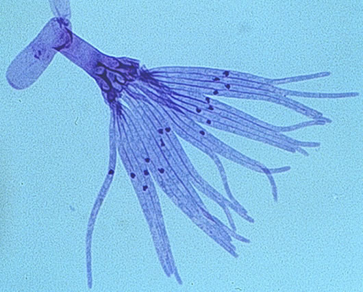 Slide view of Tilletia