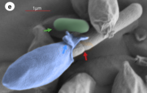A micrograph of botulism, a rod bacteria, shedding its balloon-like spore. A free bacteria is also visible.