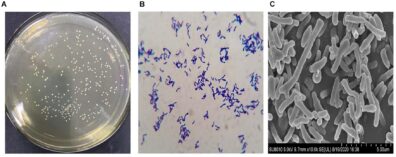 Three images of bacteria. The left is in a petri dish, the middle is colorized purple, the right is black and white