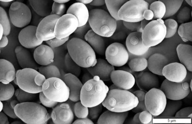 Black and white micrograph of yeast cells, which are a cluster of oblong spheres with smaller spheres visible on their surfaces