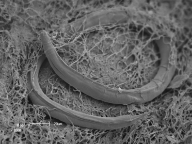 A black and white micrograph showing a smooth worm curled up