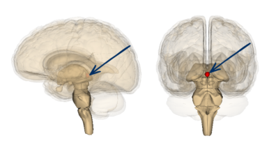 Side and front drawings of human with pineal gland in red and a blue arrow pointing to it
