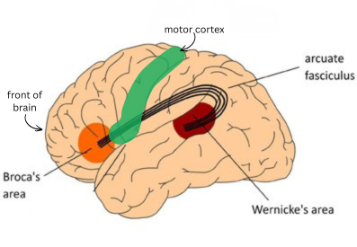 Brain diagram shows broca's area in orange, wernicke's area in red, and motor cortex in green