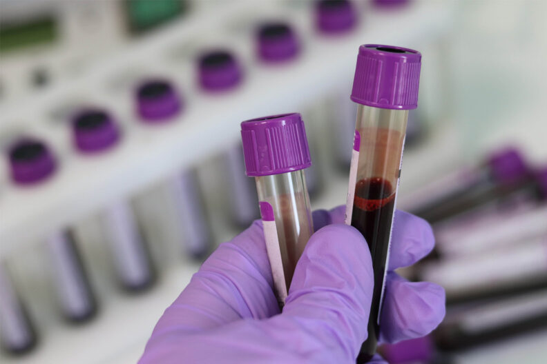 Two blood samples being held by a lab technician.