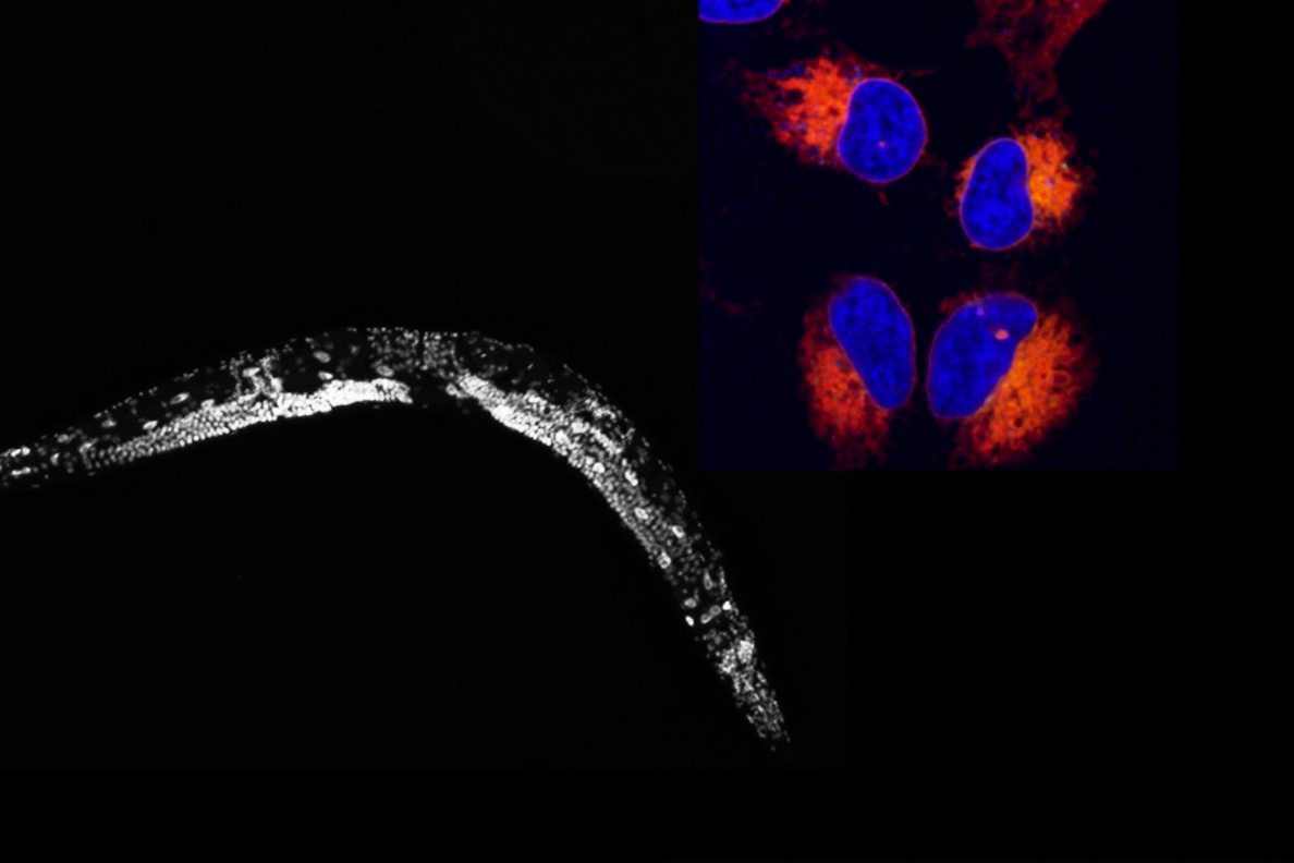 White and gray nematode and blue and orange glowing cancer cells on a black background.