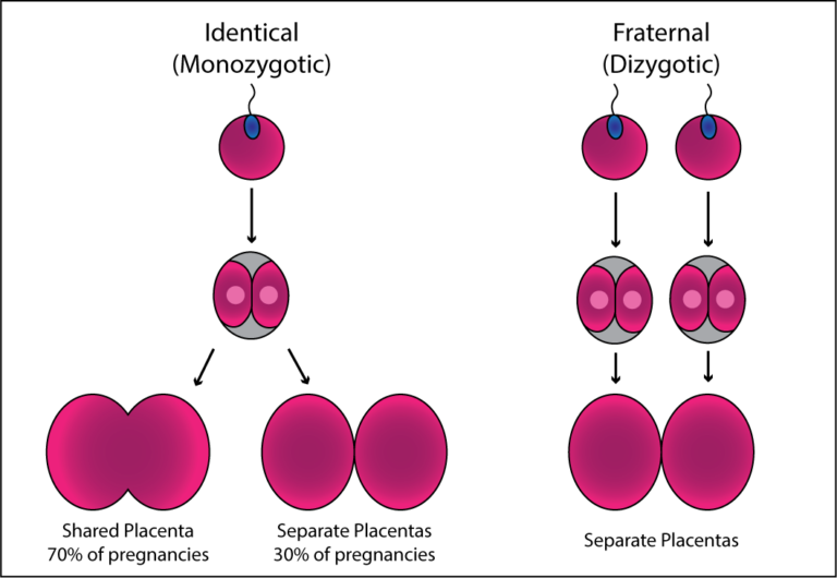 Identical vs. Fraternal Twins | Washington State Twin Registry ...