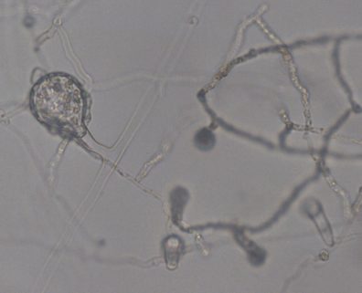 Saprolegnia oogonium being parasitized by Pythium 