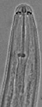 H-filipjevi-nematode-from-Science-Alert