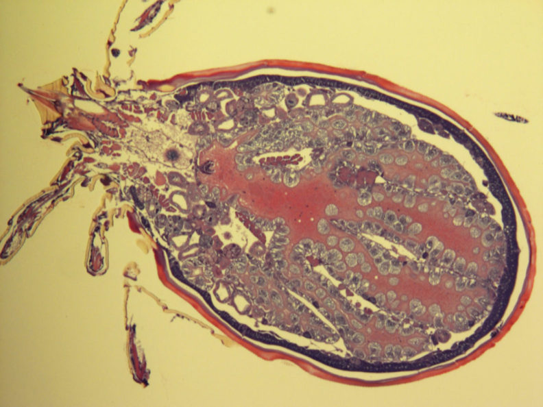 X-ray of a tick