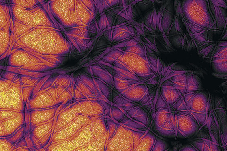 Image of prions.