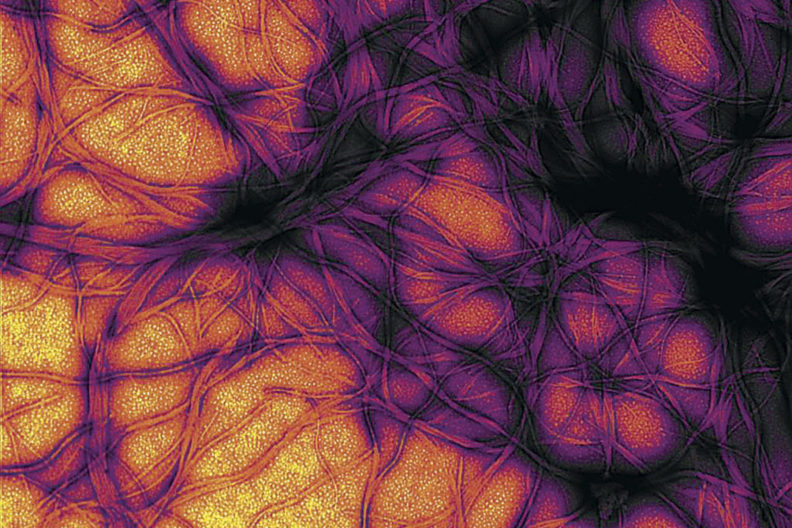 Microscopic look at prion cells.