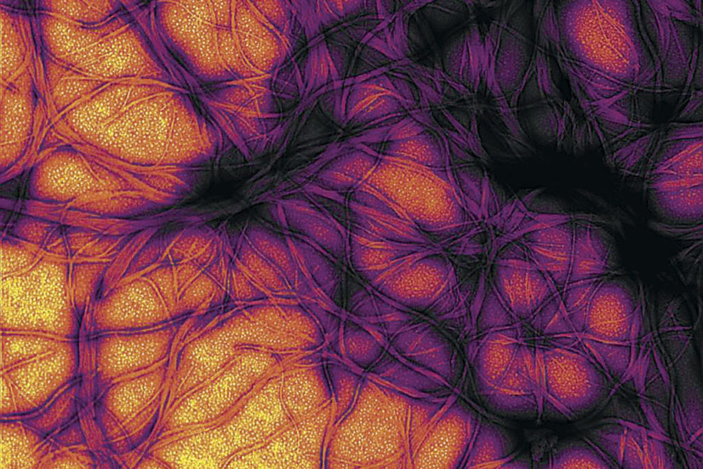 Microscopic look at prion cells.
