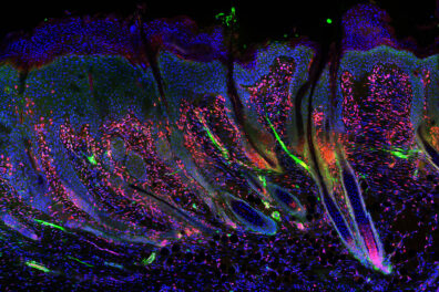 A dark close up image of the skin with areas highlighted by luminescent color