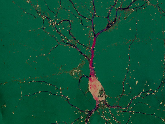 A single neuron from a rat’s hippocampus, an area of the brain essential for learning and memory. The bulbous part is the cell body. fluorescent color markers have been attached to specific proteins to allow researchers to assess the length and complexity of dendrites (green) and the number and size of dendritic spines (red). Each spine is part of a synapse, where this neuron receives incoming signals from other neurons. Photomicrograph courtesy Gary Wayman.